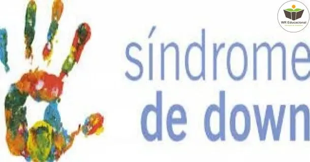 Curso de Síndrome de Down - O Olhar na Educação