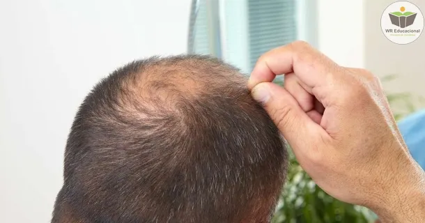 Curso Noções Básicas em Tricoterapia Capilar
