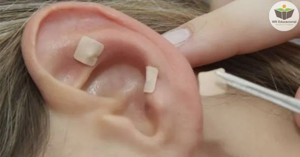 Curso de educação a distância de Noções Básicas em Auriculoterapia
